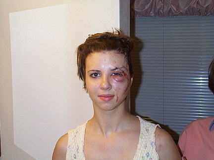Sarah's accident